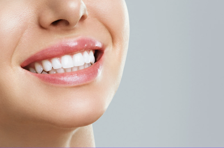 Teeth Whitening